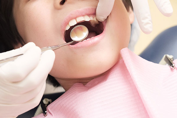 混合歯列期の治療