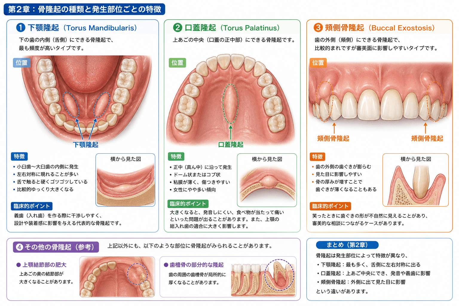 骨 隆起 ストレス